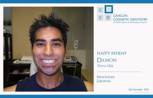 Another Happy Patient thanks to Affordable Dentists in Cancun!