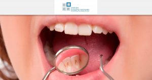 Get a dental cleaning in Cancun! It’s quick and easy!