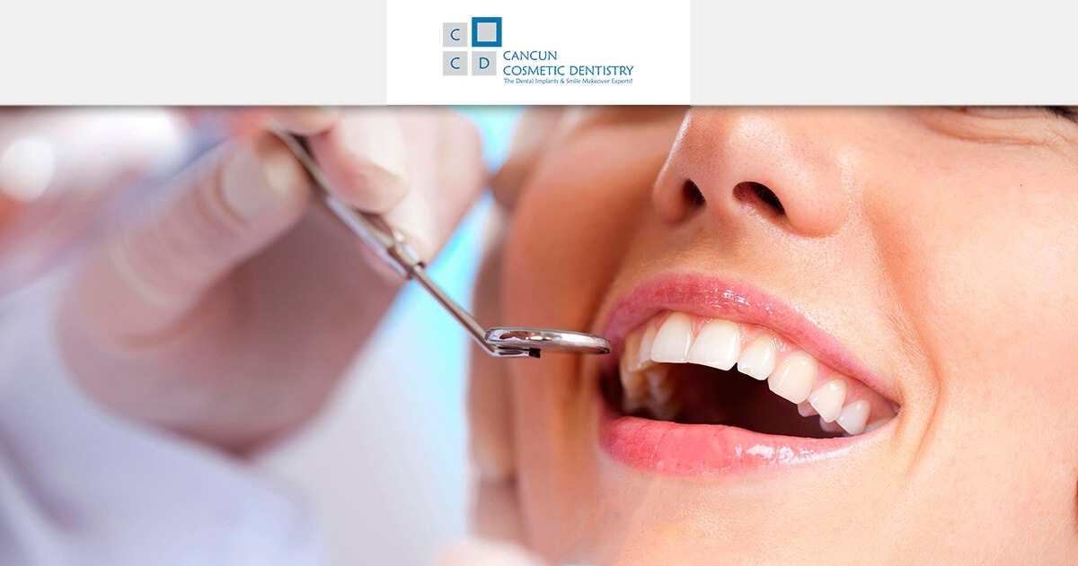 Get rid of dental stains on Cancun Cosmetic Dentistry!