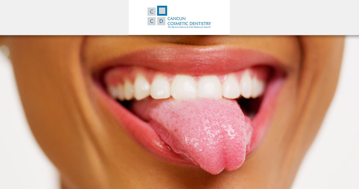 Clean your tongue to prevent halitosis bad breath - Cancun Cosmetic Dentistry